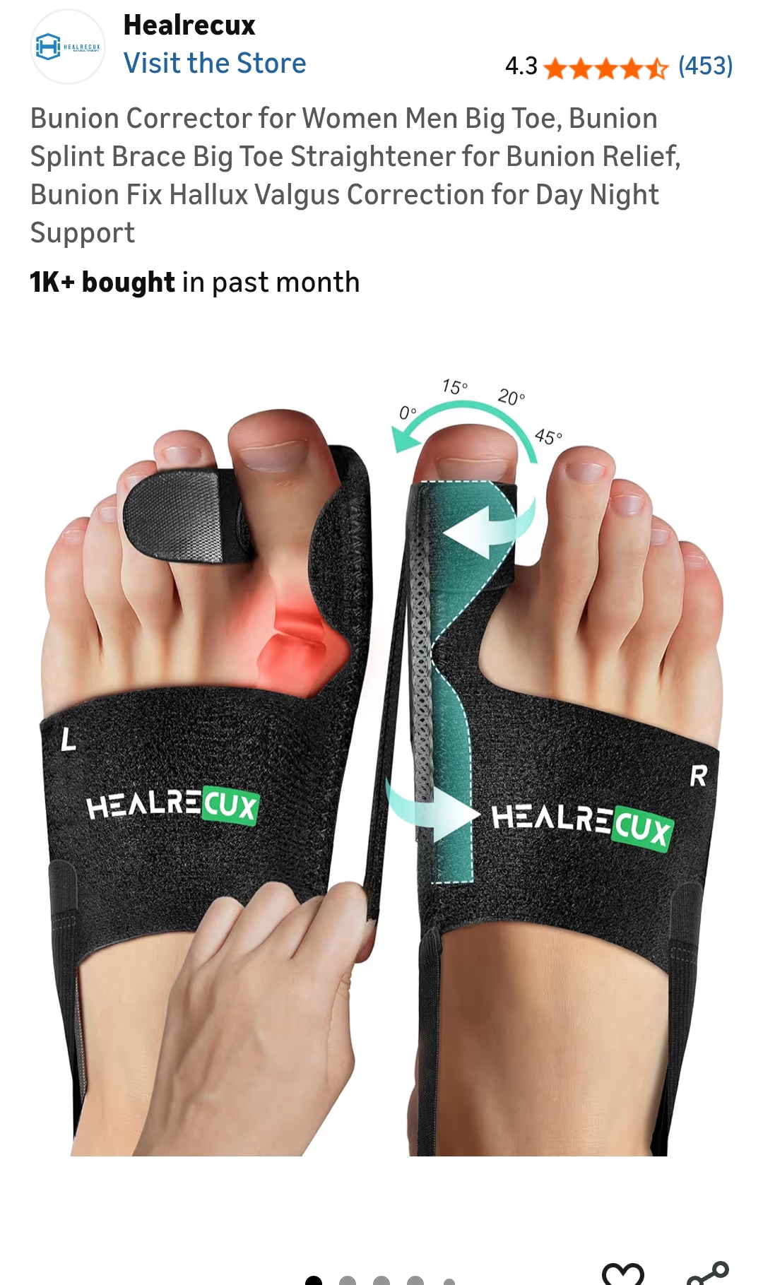bunion corrector