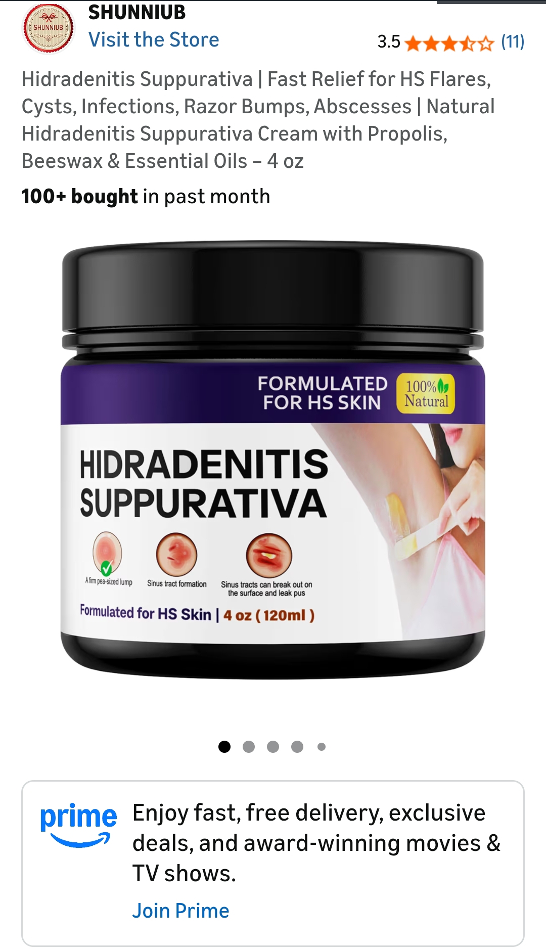 Hidradenitis Suppurativa